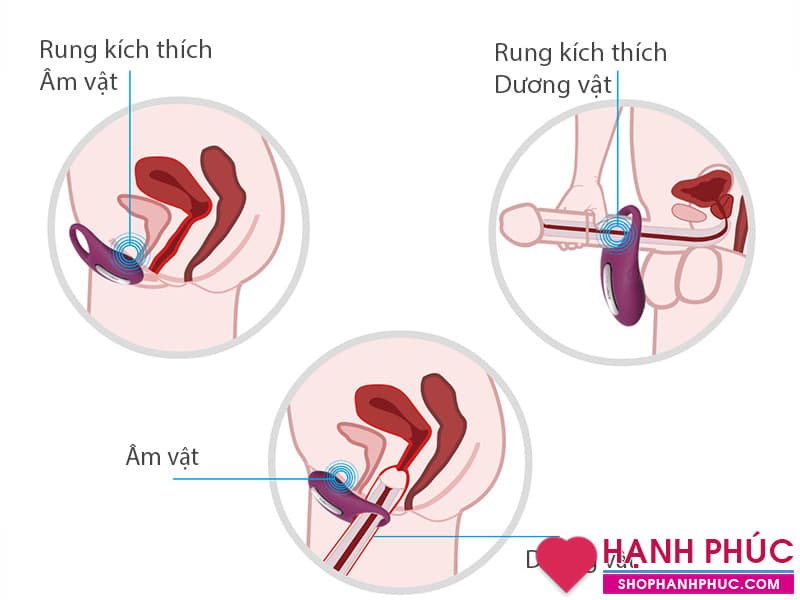 Winne-S Vòng Rung Cao Cấp Số 1 USA Đã Lộ Diện 03